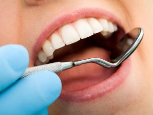 checking teeth cavity photo