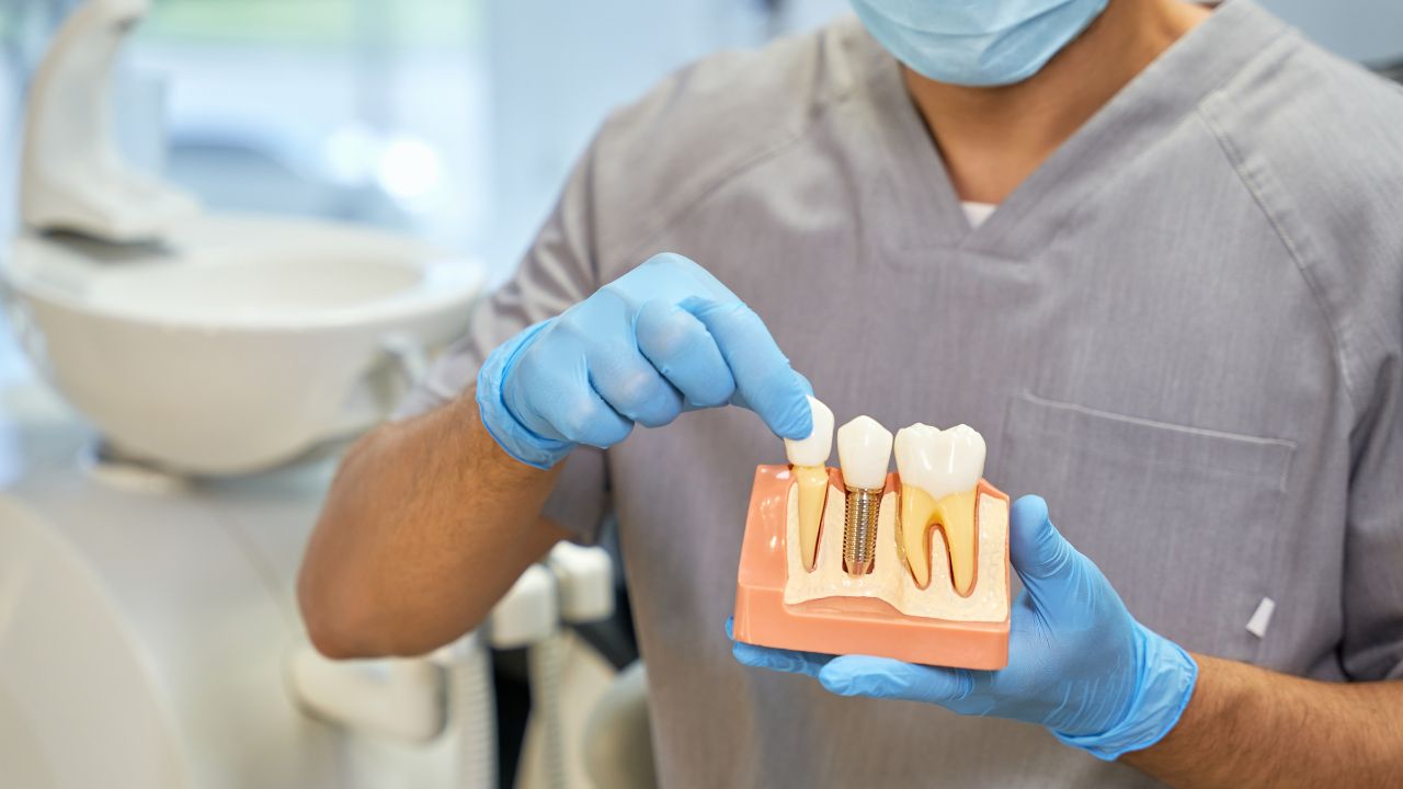what is dental implant